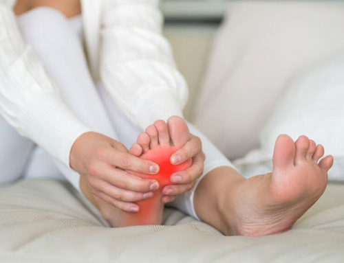 Plantar Fasciitis How to Overcome the Pain