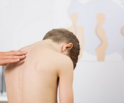 Does Scoliosis Automatically Mean Surgery?