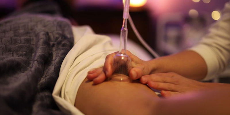 Medicupping therapy at Circle Chiropractic